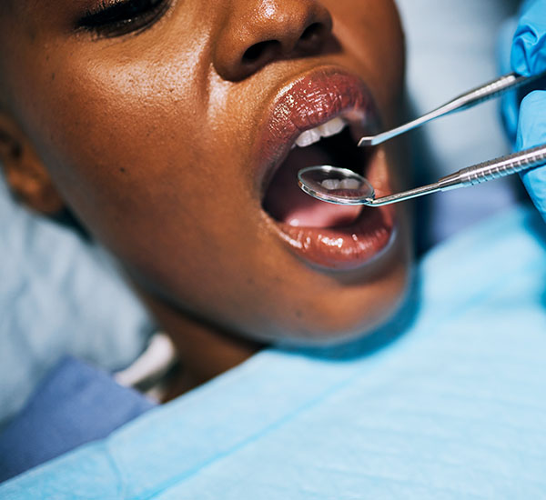 Gum Care Prevention